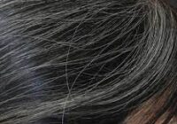 سفید شدن موها از سرطان پوست جلوگیری می‌کند